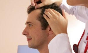 Best Hair Loss Treatment for Men Cover