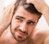 Sudden Hair Loss in Men