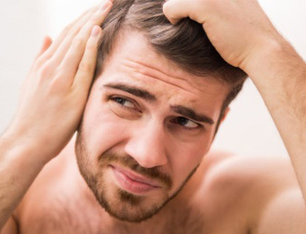 Sudden Hair Loss in Men